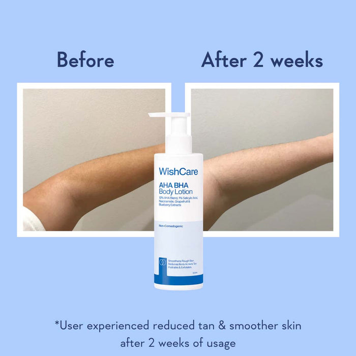 WishCare AHA + BHA Body Lotion - 200ml