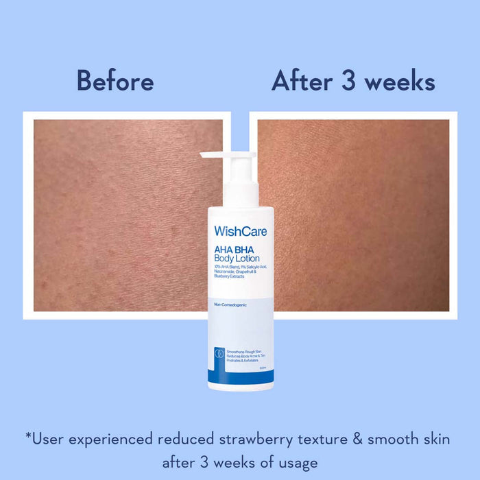 WishCare AHA + BHA Body Lotion - 200ml